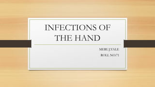 INFECTIONS OF
THE HAND
MERU.J.YALE
ROLL NO:71
 