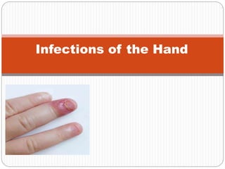Infections of the Hand
 