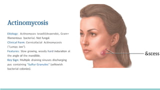 Infections of the Oral Cavity - COMPREHENSIVE REVIEW | PPTX