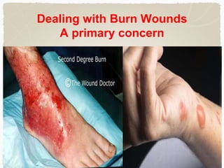 Primary care in handling wounds
makes the difference
 