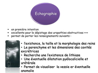 Echographie



 en première intention
 excellente pour le dépistage des uropathies obstructives +++
 permet de porter les renseignements suivants :

          • l’existence, la taille et la morphologie des reins
          • Le parenchyme et les dimensions des cavités
          excrétrices
          • Recherche une l’existence de lithiase
          • Une éventuelle dilatation pyélocalicielle et
          urétérale
          • Permet de visualiser la vessie er éventuelle
          anomalie
 