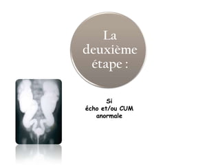 La
deuxième
 étape :

       Si
écho et/ou CUM
   anormale
 