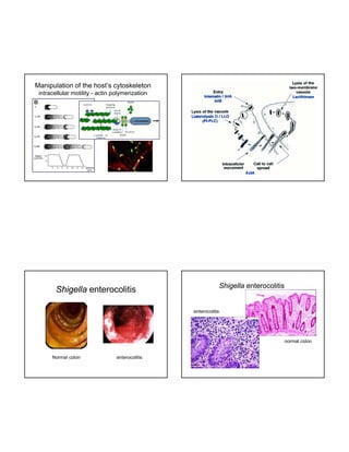 Manipulation of the host’s cytoskeleton
intracellular motility - actin polymerization

Shigella enterocolitis

Shigella enterocolitis

enterocolitis

normal colon
Normal colon

enterocolitis

 
