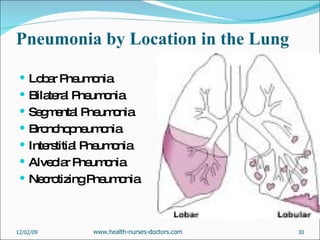 Pneumonia by Location in the Lung Lobar Pneumonia Bilateral Pneumonia Segmental Pneumonia Bronchopneumonia Interstitial Pneumonia Alveolar Pneumonia Necrotizing Pneumonia 06/07/09 www.health-nurses-doctors.com 