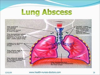 06/07/09 www.health-nurses-doctors.com 