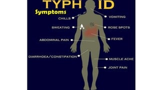 Infectious agents 3 for class 9