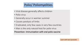 Polio/ Poliomyelities
• Viral disease generally affects children
• Polio virus
• Generally occur in warmer summer
• Causes paralysis of limbs
• Eradicated, only few cases in very few countries
• Man is the only natural host for polio virus
Prevention- Immunization with oral polio vaccine
Learn with Saro (youtube)
 