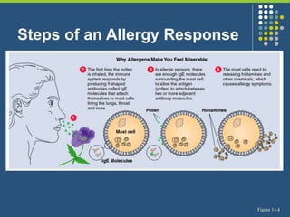 Steps of an Allergy Response
Figure 14.4
 