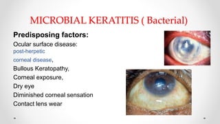 MICROBIAL KERATITIS ( Bacterial)
Predisposing factors:
Ocular surface disease: Trauma,
post-herpetic
corneal disease,
Bullous Keratopathy,
Corneal exposure,
Dry eye
Diminished corneal sensation
Contact lens wear
 