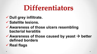 Differentiators
 Dull grey infiltrate.
 Satellite lesions.
 Awareness of those ulcers resembling
bacterial keratitis
 Awareness of those caused by yeast  better
defined borders
 Real flags
 