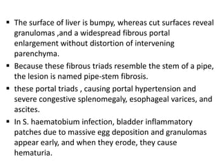  The surface of liver is bumpy, whereas cut surfaces reveal
  granulomas ,and a widespread fibrous portal
  enlargement without distortion of intervening
  parenchyma.
 Because these fibrous triads resemble the stem of a pipe,
  the lesion is named pipe-stem fibrosis.
 these portal triads , causing portal hypertension and
  severe congestive splenomegaly, esophageal varices, and
  ascites.
 In S. haematobium infection, bladder inflammatory
  patches due to massive egg deposition and granulomas
  appear early, and when they erode, they cause
  hematuria.
 