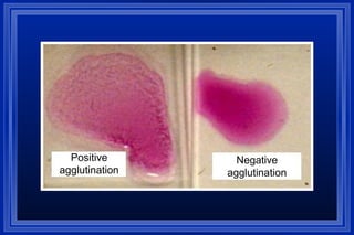 Positive
agglutination
Negative
agglutination
 