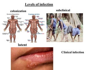 colonization subclinical
latent
Clinical infection
Levels of infection
 