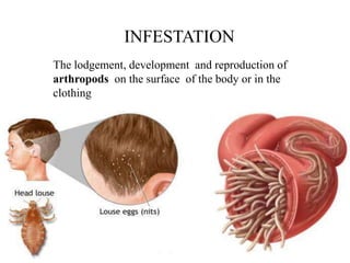 The lodgement, development and reproduction of
arthropods on the surface of the body or in the
clothing
INFESTATION
 