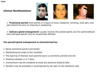 Cont.Laboratory And Imaging Studies: The diagnosis of viral encephalitis is supported by examination of the CSF, which typically shows a lymphocytic pleocytosis, slight elevation in protein content, and normal glucose level. Increased erythrocytes and CSF protein may occur with HSV.