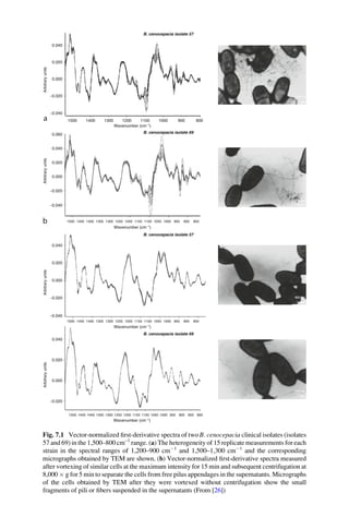 ArbitraryunitsArbitraryunitsArbitraryunitsArbitraryunits
a
b
0.040
0.020
0.000
−0.020
−0.040
0.040
0.020
0.000
−0.020
0.040
0.020
0.000
−0.020
−0.040
0.040
0.060
0.020
0.000
−0.020
−0.040
B. cenocepacia isolate 69
B. cenocepacia isolate 57
B. cenocepacia isolate 69
1500 1400 1300 1100 1000 900 8001200
1500 1450 1400 13001350 11001150 10001050 900950 85012001250
1500 1450 1400 13001350 11001150 10001050 900950 85012001250
Wavenumber (cm−1
)
Wavenumber (cm−1
)
Wavenumber (cm−1
)
1500 1450 1400 13001350 11001150 10001050 900950 80085012001250
Wavenumber (cm−1
)
B. cenocepacia isolate 57
Fig. 7.1 Vector-normalized ﬁrst-derivative spectra of two B. cenocepacia clinical isolates (isolates
57 and 69) in the 1,500–800 cm–1
range. (a) The heterogeneity of 15 replicate measurements for each
strain in the spectral ranges of 1,200–900 cmÀ1
and 1,500–1,300 cmÀ1
and the corresponding
micrographs obtained by TEM are shown. (b) Vector-normalized ﬁrst-derivative spectra measured
after vortexing of similar cells at the maximum intensity for 15 min and subsequent centrifugation at
8,000 Â g for 5 min to separate the cells from free pilus appendages in the supernatants. Micrographs
of the cells obtained by TEM after they were vortexed without centrifugation show the small
fragments of pili or ﬁbers suspended in the supernatants (From [26])
 