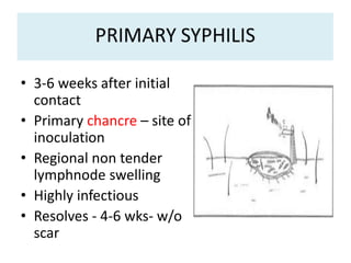 • 3-6 weeks after initial
contact
• Primary chancre – site of
inoculation
• Regional non tender
lymphnode swelling
• Highly infectious
• Resolves - 4-6 wks- w/o
scar
 