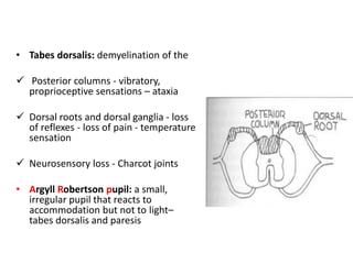 • Tabes dorsalis: demyelination of the
 Posterior columns - vibratory,
proprioceptive sensations – ataxia
 Dorsal roots and dorsal ganglia - loss
of reflexes - loss of pain - temperature
sensation
 Neurosensory loss - Charcot joints
• Argyll Robertson pupil: a small,
irregular pupil that reacts to
accommodation but not to light–
tabes dorsalis and paresis
 