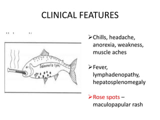 CLINICAL FEATURES
Chills, headache,
anorexia, weakness,
muscle aches
Fever,
lymphadenopathy,
hepatosplenomegaly
Rose spots –
maculopapular rash
 
