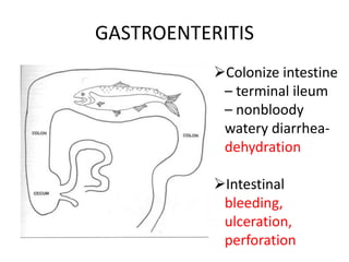 GASTROENTERITIS
Colonize intestine
– terminal ileum
– nonbloody
watery diarrhea-
dehydration
Intestinal
bleeding,
ulceration,
perforation
 