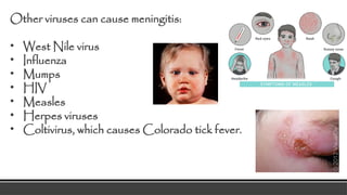 INFECTIOUS DISEASES (Meningitis,Typhoid Fever,Leprosy,Tuberculosis,UTI ...
