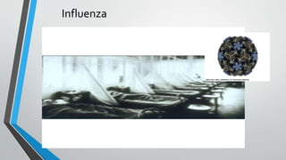 Influenza 
 
