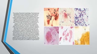 The variety of bacterial morphology. The bacteria are 
indicated by arrows in each panel. A, Gram stain of 
sputum from a patient with pneumonia. There are 
gram-positive cocci in clusters (Staphylococcus 
aureus) with degenerating neutrophils. B, Gram stain 
of sputum from a patient with pneumonia. Gram-positive, 
elongated cocci in pairs and short chains 
(Streptococcus pneumoniae) and a neutrophil are 
seen. C, Gram stain of Clostridium sordellii grown in 
culture. A mixture of gram-positive and gram-negative 
rods, many of which have subterminal 
spores (clear areas), are present. Clostridia species 
often stain as both gram-positive and gram-negative, 
although they are true gram-positive bacteria. D, 
Gram stain of a bronchoalveolar lavage specimen 
showing gram-negative intracellular rods typical of 
Enterobacteriaceae such as Klebsiella pneumoniae or 
Escherichia coli. E, Gram stain of urethral discharge 
from a patient with gonorrhea. Many gram-negative 
diplococci (Neisseria gonorrhoeae) are present within 
a neutrophil. F, Silver stain of brain tissue from a 
patient with Lyme disease meningoencephalitis. Two 
helical spirochetes (Borrelia burgdorferi) are indicated 
by arrows. The panels are at different magnifications. 
 