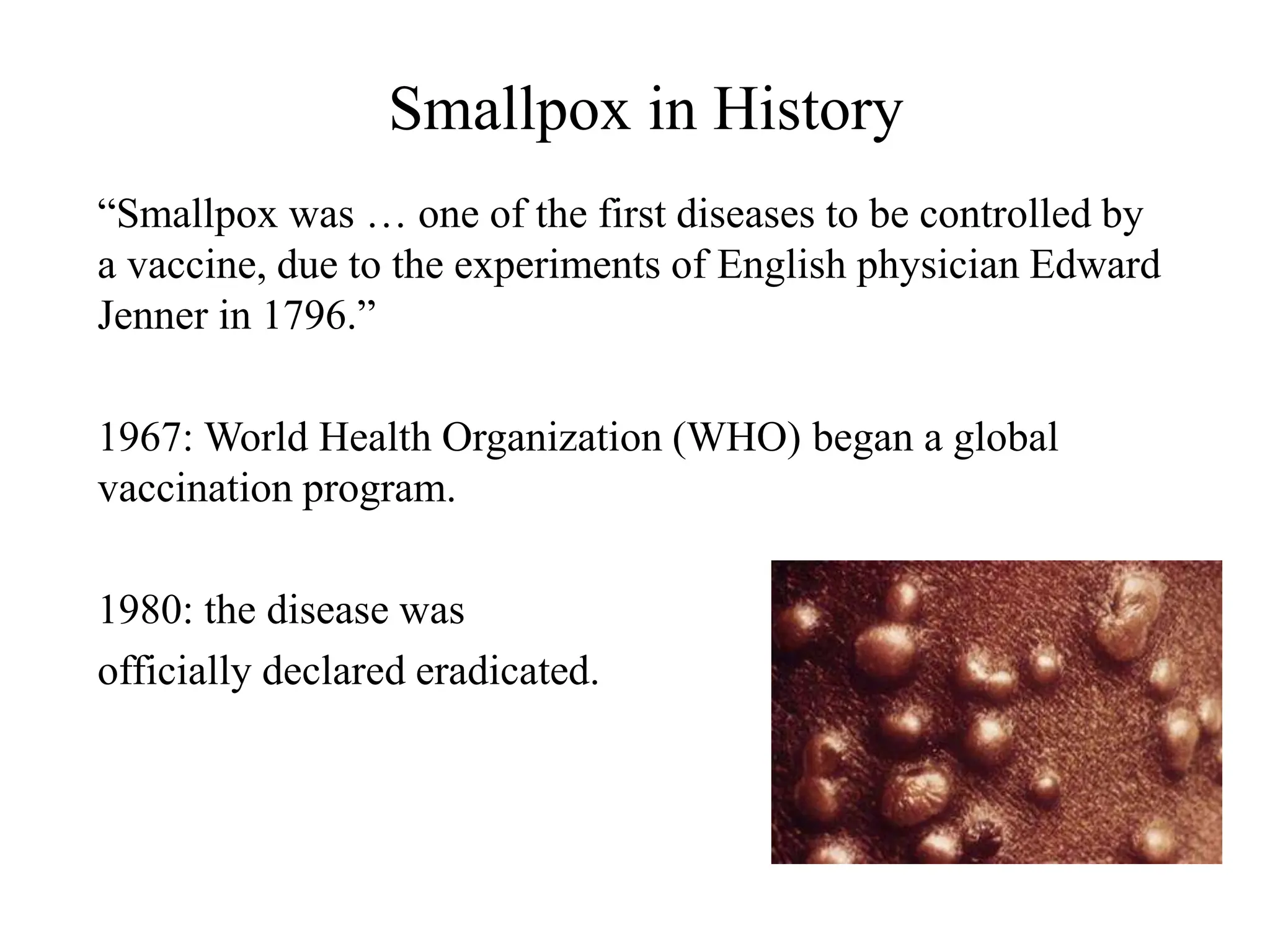 Smallpox in History
“Smallpox was … one of the first diseases to be controlled by
a vaccine, due to the experiments of English physician Edward
Jenner in 1796.”
1967: World Health Organization (WHO) began a global
vaccination program.
1980: the disease was
officially declared eradicated.
 