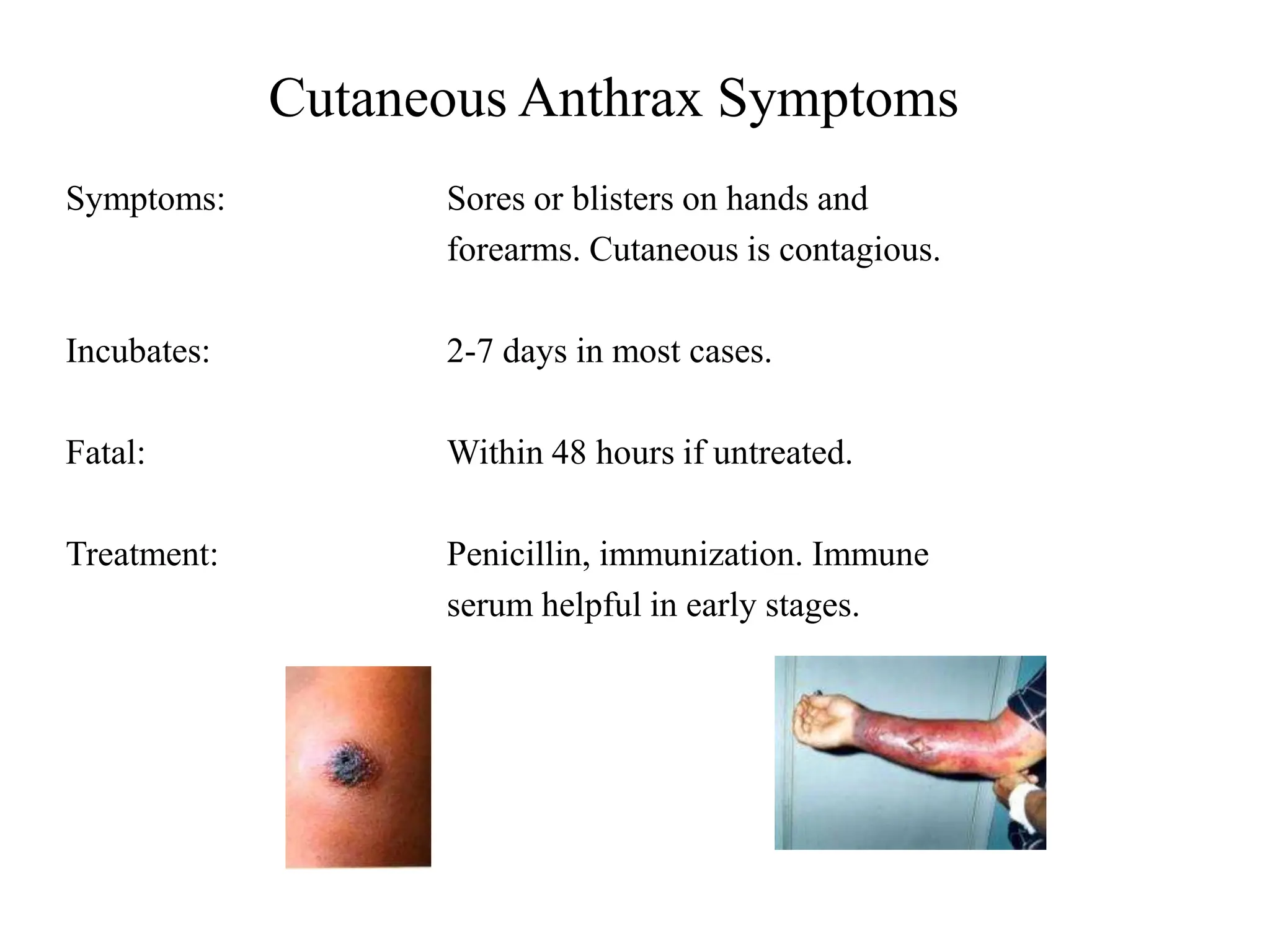 Cutaneous Anthrax Symptoms
Symptoms: Sores or blisters on hands and
forearms. Cutaneous is contagious.
Incubates: 2-7 days in most cases.
Fatal: Within 48 hours if untreated.
Treatment: Penicillin, immunization. Immune
serum helpful in early stages.
 