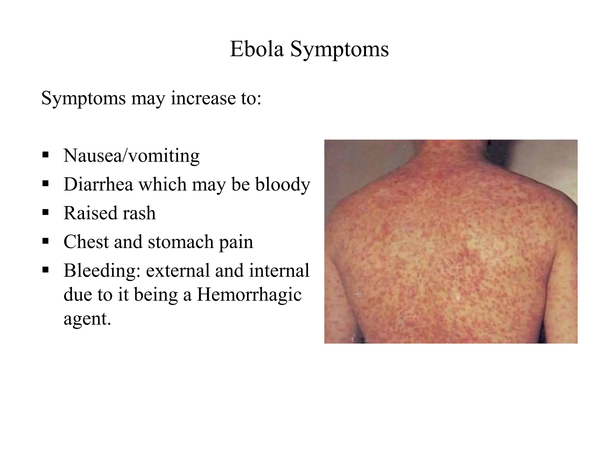 Ebola Symptoms
Symptoms may increase to:
 Nausea/vomiting
 Diarrhea which may be bloody
 Raised rash
 Chest and stomach pain
 Bleeding: external and internal
due to it being a Hemorrhagic
agent.
 