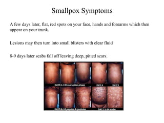 Smallpox Infection Infectious Diseases introduction and history.ppt