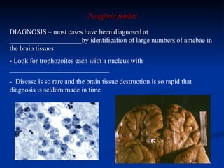 Naegleria fowleri DIAGNOSIS –  most cases have been diagnosed at _____________________by identification of large numbers of amebae in the brain tissues  Look for trophozoites each with a nucleus with _____________________________ -  Disease is so rare and the brain tissue destruction is so rapid that diagnosis is seldom made in time 
