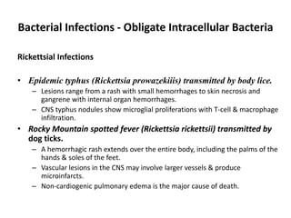 Bacterial Infections - Obligate Intracellular Bacteria
Rickettsial Infections
• Epidemic typhus (Rickettsia prowazekiiis) transmitted by body lice.
– Lesions range from a rash with small hemorrhages to skin necrosis and
gangrene with internal organ hemorrhages.
– CNS typhus nodules show microglial proliferations with T-cell & macrophage
infiltration.
• Rocky Mountain spotted fever (Rickettsia rickettsii) transmitted by
dog ticks.
– A hemorrhagic rash extends over the entire body, including the palms of the
hands & soles of the feet.
– Vascular lesions in the CNS may involve larger vessels & produce
microinfarcts.
– Non-cardiogenic pulmonary edema is the major cause of death.
 