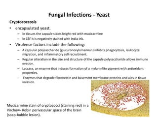 Fungal Infections - Yeast
Cryptococcosis
• encapsulated yeast.
– in tissues the capsule stains bright red with mucicarmine
– in CSF it is negatively stained with India ink.
• Virulence factors include the following:
– A capsular polysaccharide (glucuronoxylomannan) inhibits phagocytosis, leukocyte
migration, and inflammatory cell recruitment.
– Regular alteration in the size and structure of the capsule polysaccharide allows immune
evasion.
– Laccase, an enzyme that induces formation of a melaninlike pigment with antioxidant
properties.
– Enzymes that degrade fibronectin and basement membrane proteins and aids in tissue
invasion.
Mucicarmine stain of cryptococci (staining red) in a
Virchow- Robin perivascular space of the brain
(soap-bubble lesion).
 
