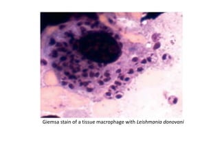 Giemsa stain of a tissue macrophage with Leishmania donovani
 