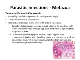 Parasitic Infections - Metazoa
Tapeworms (Cestodes): Cysticercosis
• caused by larval development after the ingestion of eggs
• Taenia solium causes cysticercosis.
• transmitted to humans in two ways with distinct outcomes:
– Larval cysts (cysticerci) ingested in pork attach to the intestinal wall
where they mature and produce egg-laden proglottids (segments) that
are passed in stool.
– If intermediate hosts (pigs or humans) ingest eggs in feces
contaminated food or water, hatching larvae penetrate the gut wall, and
disseminate to encyst in many organs, including the brain (causing
severe neurologic manifestations).
 