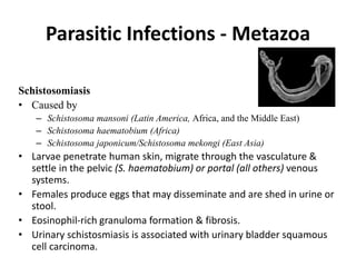 Parasitic Infections - Metazoa
Schistosomiasis
• Caused by
– Schistosoma mansoni (Latin America, Africa, and the Middle East)
– Schistosoma haematobium (Africa)
– Schistosoma japonicum/Schistosoma mekongi (East Asia)
• Larvae penetrate human skin, migrate through the vasculature &
settle in the pelvic (S. haematobium) or portal (all others) venous
systems.
• Females produce eggs that may disseminate and are shed in urine or
stool.
• Eosinophil-rich granuloma formation & fibrosis.
• Urinary schistosmiasis is associated with urinary bladder squamous
cell carcinoma.
 