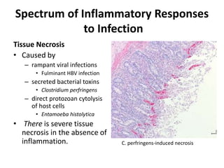 Spectrum of Inflammatory Responses
to Infection
Tissue Necrosis
• Caused by
– rampant viral infections
• Fulminant HBV infection
– secreted bacterial toxins
• Clostridium perfringens
– direct protozoan cytolysis
of host cells
• Entamoeba histolytica
• There is severe tissue
necrosis in the absence of
inflammation. C. perfringens-induced necrosis
 