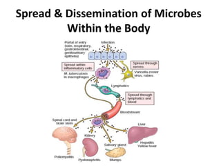 Spread & Dissemination of Microbes
Within the Body
 