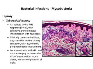 Bacterial Infections - Mycobacteria
Leprosy
• Tuberculoid leprosy
– Associated with a TH1
response (IFN-γ), with
extensive granulomatous
inflammation with few bacilli.
– Clinically there are insidious,
dry, scaly skin lesions lacking
sensation, with asymmetric
peripheral nerve involvement.
– Local anesthesia with skin and
muscle atrophy increases the
risk of trauma with chronic
ulcers, and autoamputation of
digits.
 