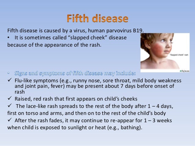 5th disease picture