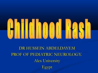 DR HUSSEIN ABDELDAYEM
PROF OF PEDIATRIC NEUROLOGY.
          Alex University
              Egypt
 