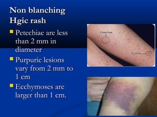 Infectious disease skin rash | PPT