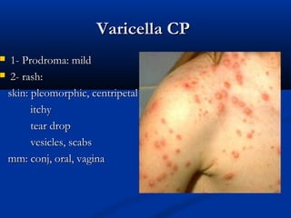 Infectious disease skin rash | PPT
