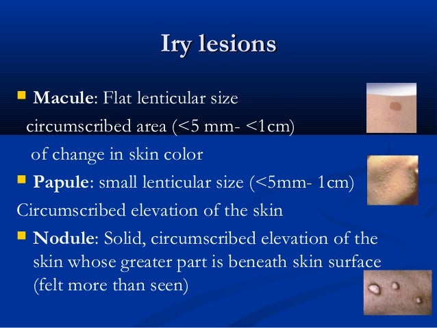 Infectious disease skin rash