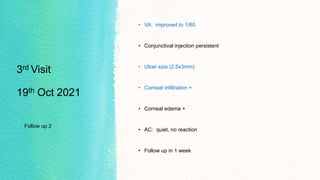 3rd Visit
19th Oct 2021
Follow up 2
• VA: improved to 1/60
• Conjunctival injection persistent
• Ulcer size (2.5x3mm)
• Corneal infiltration +
• Corneal edema +
• AC: quiet, no reaction
• Follow up in 1 week
 