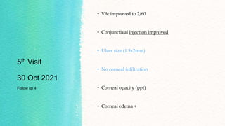 5th Visit
30 Oct 2021
Follow up 4
• VA: improved to 2/60
• Conjunctival injection improved
• Ulcer size (1.5x2mm)
• No corneal infiltration
• Corneal opacity (ppt)
• Corneal edema +
 