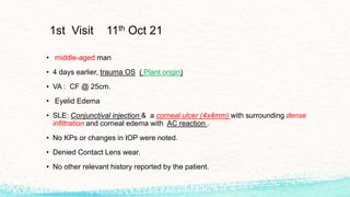 1st Visit 11th Oct 21
• middle-aged man
• 4 days earlier, trauma OS ( Plant origin)
• VA : CF @ 25cm.
• Eyelid Edema
• SLE: Conjunctival injection & a corneal ulcer (4x4mm) with surrounding dense
infiltration and corneal edema with AC reaction .
• No KPs or changes in IOP were noted.
• Denied Contact Lens wear.
• No other relevant history reported by the patient.
 