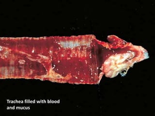 Trachea filled with blood
and mucus
 