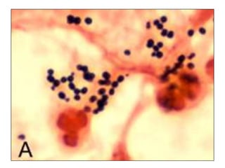Introduction to Infectious Diseases and Bacterial Infections | PPTX
